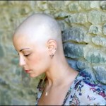 bald-woman via womensviewsonnews.org